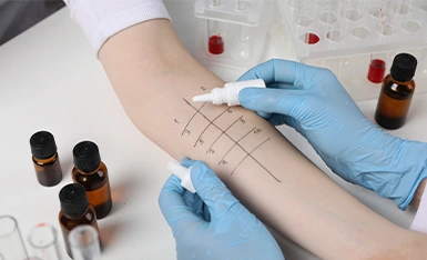 Alergologia Alergologia